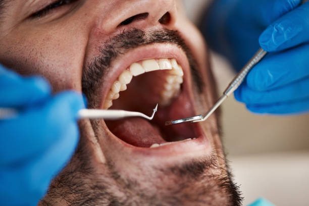 Best Emergency Treatment for Toothache in Pine Nyon, CA